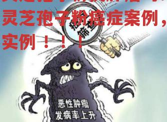 灵芝孢子粉抗肿瘤吗？灵芝孢子粉癌症案例，实例 ！！！-第2张图片-超越