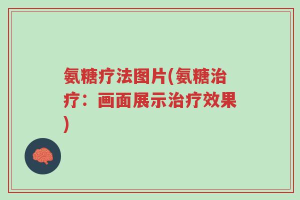 氨糖疗法图片(氨糖治疗:画面展示治疗效果)-第1张图片-超越 氨糖疗法图片(氨糖治疗:画面展示治疗效果)-第1张图片-超越