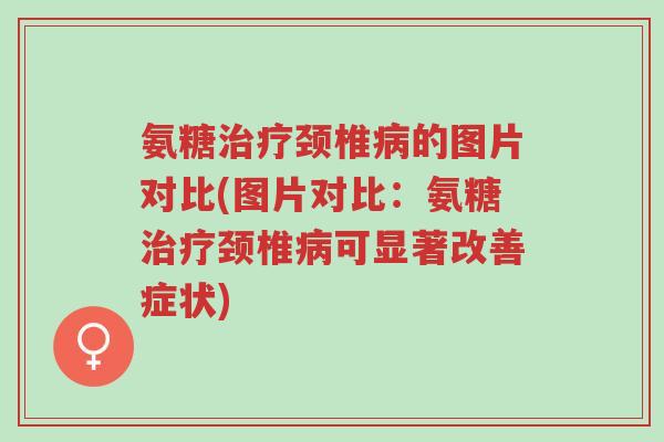 氨糖治疗颈椎病的图片对比(图片对比:氨糖治疗颈椎病可显著改善症状)-第1张图片-超越 氨糖治疗颈椎病的图片对比(图片对比:氨糖治疗颈椎病可显著改善症状)-第1张图片-超越