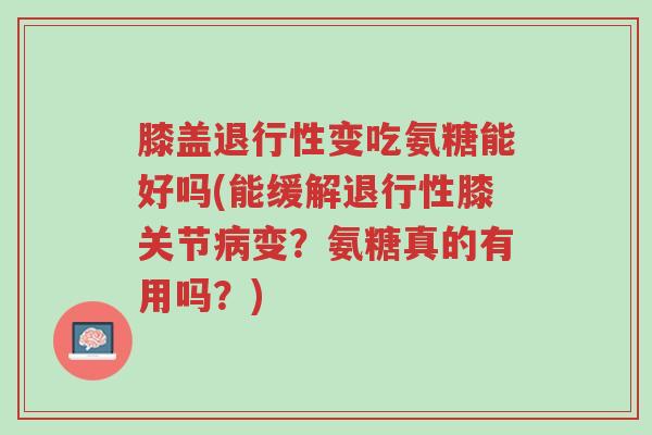膝盖退行性变吃氨糖能好吗(能缓解退行性膝关节病变?氨糖真的有用吗?)-第1张图片-超越 膝盖退行性变吃氨糖能好吗(能缓解退行性膝关节病变?氨糖真的有用吗?)-第1张图片-超越