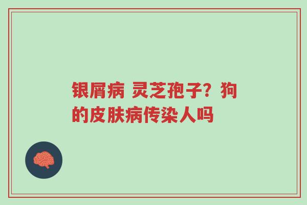 银屑病 灵芝孢子?狗的皮肤病传染人吗-第1张图片-超越 银屑病 灵芝孢子?狗的皮肤病传染人吗-第1张图片-超越