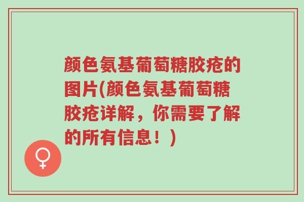颜色氨基葡萄糖胶疮的图片(颜色氨基葡萄糖胶疮详解,你需要了解的所有信息!)-第1张图片-超越 颜色氨基葡萄糖胶疮的图片(颜色氨基葡萄糖胶疮详解,你需要了解的所有信息!)-第1张图片-超越