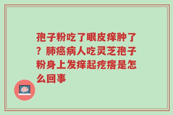 孢子粉吃了眼皮痒肿了?肺癌病人吃灵芝孢子粉身上发痒起疙瘩是怎么回事-第1张图片-超越 孢子粉吃了眼皮痒肿了?肺癌病人吃灵芝孢子粉身上发痒起疙瘩是怎么回事-第1张图片-超越