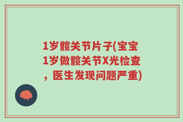 1岁髋关节片子(宝宝1岁做髋关节X光检查,医生发现问题严重)-第1张图片-超越 1岁髋关节片子(宝宝1岁做髋关节X光检查,医生发现问题严重)-第1张图片-超越