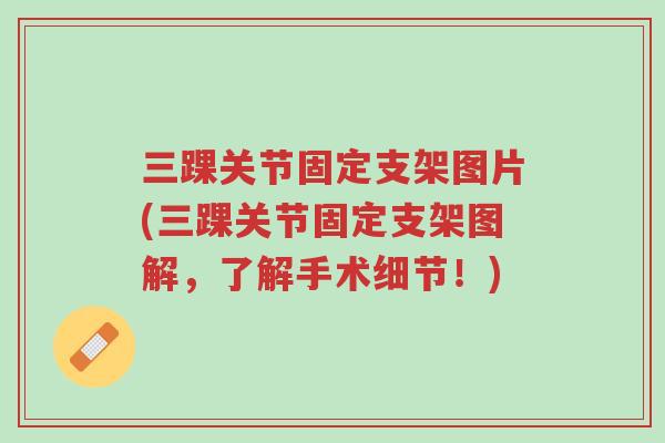 三踝关节固定支架图片(三踝关节固定支架图解，了解手术细节！)-第1张图片-超越