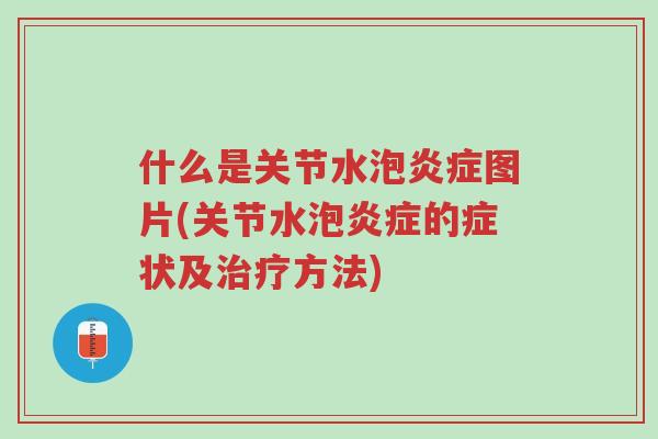 什么是关节水泡炎症图片(关节水泡炎症的症状及治疗方法)-第1张图片-超越