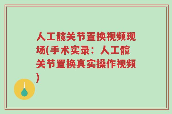 人工髋关节置换视频现场(手术实录：人工髋关节置换真实操作视频)-第1张图片-超越
