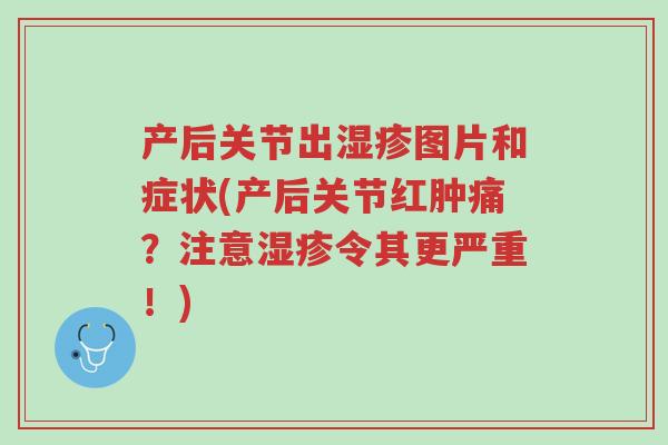 产后关节出湿疹图片和症状(产后关节红肿痛?注意湿疹令其更严重!)-第1张图片-超越 产后关节出湿疹图片和症状(产后关节红肿痛?注意湿疹令其更严重!)-第1张图片-超越