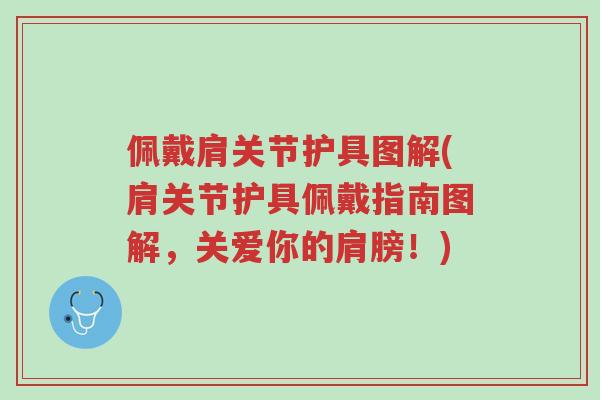 佩戴肩关节护具图解(肩关节护具佩戴指南图解,关爱你的肩膀!)-第1张图片-超越 佩戴肩关节护具图解(肩关节护具佩戴指南图解,关爱你的肩膀!)-第1张图片-超越