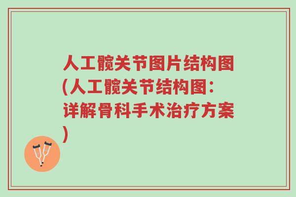 人工髋关节图片结构图(人工髋关节结构图:详解骨科手术治疗方案)-第1张图片-超越 人工髋关节图片结构图(人工髋关节结构图:详解骨科手术治疗方案)-第1张图片-超越