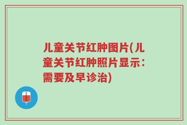 儿童关节红肿图片(儿童关节红肿照片显示:需要及早诊治)-第1张图片-超越 儿童关节红肿图片(儿童关节红肿照片显示:需要及早诊治)-第1张图片-超越