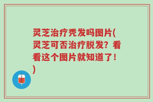 灵芝治疗秃发吗图片(灵芝可否治疗脱发？看看这个图片就知道了！)-第1张图片-超越