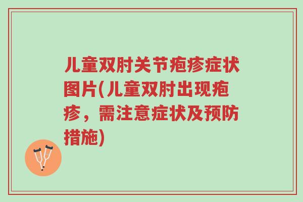 儿童双肘关节疱疹症状图片(儿童双肘出现疱疹,需注意症状及预防措施)-第1张图片-超越 儿童双肘关节疱疹症状图片(儿童双肘出现疱疹,需注意症状及预防措施)-第1张图片-超越