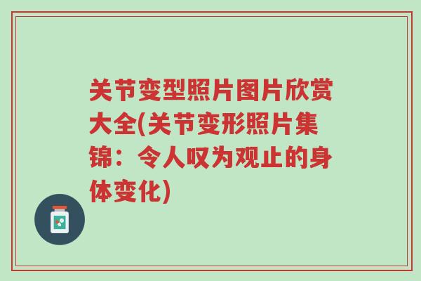 关节变型照片图片欣赏大全(关节变形照片集锦:令人叹为观止的身体变化)-第1张图片-超越 关节变型照片图片欣赏大全(关节变形照片集锦:令人叹为观止的身体变化)-第1张图片-超越