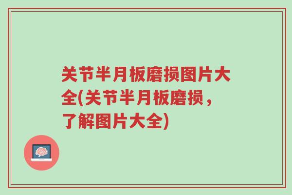 关节半月板磨损图片大全(关节半月板磨损,了解图片大全)-第1张图片-超越 关节半月板磨损图片大全(关节半月板磨损,了解图片大全)-第1张图片-超越