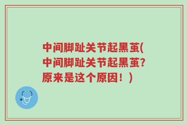 中间脚趾关节起黑茧(中间脚趾关节起黑茧?原来是这个原因!)-第1张图片-超越 中间脚趾关节起黑茧(中间脚趾关节起黑茧?原来是这个原因!)-第1张图片-超越