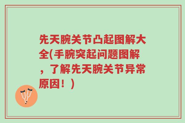 先天腕关节凸起图解大全(手腕突起问题图解,了解先天腕关节异常原因!)-第1张图片-超越 先天腕关节凸起图解大全(手腕突起问题图解,了解先天腕关节异常原因!)-第1张图片-超越