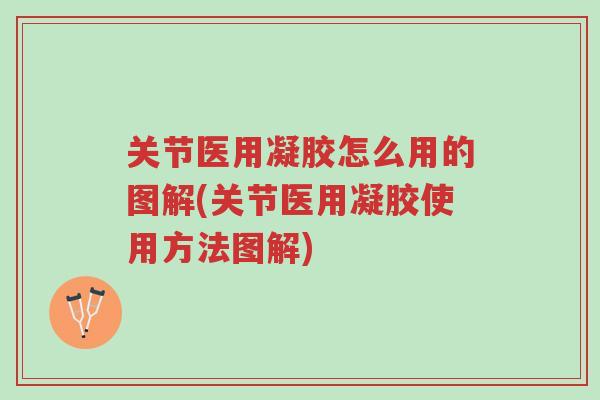 关节医用凝胶怎么用的图解(关节医用凝胶使用方法图解)-第1张图片-超越 关节医用凝胶怎么用的图解(关节医用凝胶使用方法图解)-第1张图片-超越