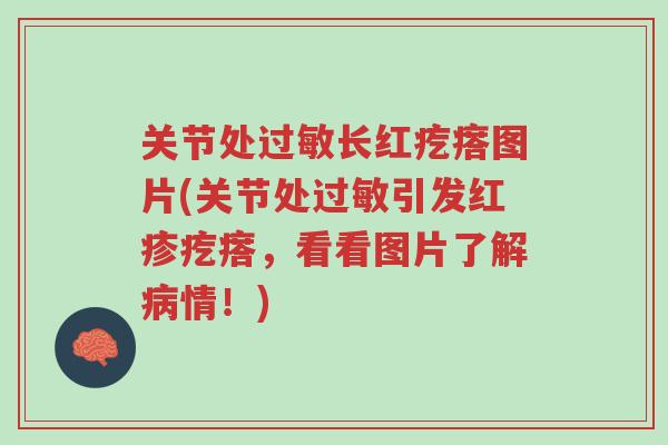 关节处过敏长红疙瘩图片(关节处过敏引发红疹疙瘩，看看图片了解病情！)-第1张图片-超越