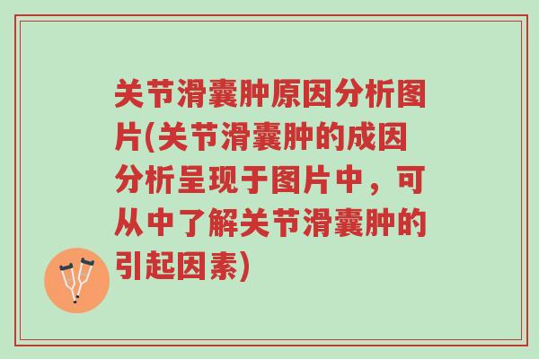 关节滑囊肿原因分析图片(关节滑囊肿的成因分析呈现于图片中,可从中了解关节滑囊肿的引起因素)-第1张图片-超越 关节滑囊肿原因分析图片(关节滑囊肿的成因分析呈现于图片中,可从中了解关节滑囊肿的引起因素)-第1张图片-超越