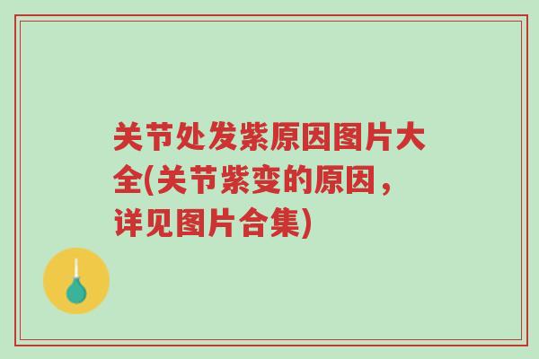 关节处发紫原因图片大全(关节紫变的原因,详见图片合集)-第1张图片-超越 关节处发紫原因图片大全(关节紫变的原因,详见图片合集)-第1张图片-超越