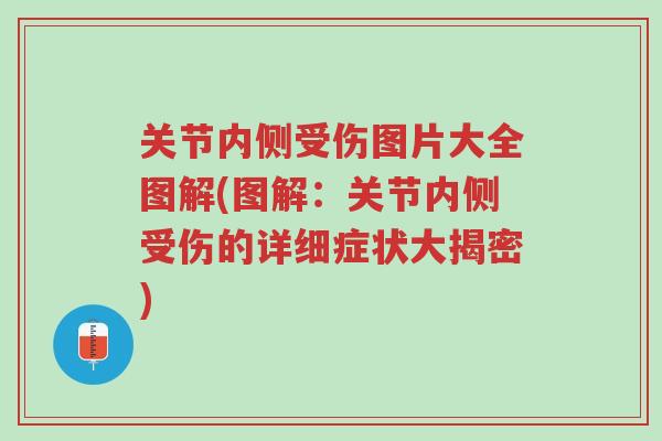 关节内侧受伤图片大全图解(图解:关节内侧受伤的详细症状大揭密)-第1张图片-超越 关节内侧受伤图片大全图解(图解:关节内侧受伤的详细症状大揭密)-第1张图片-超越