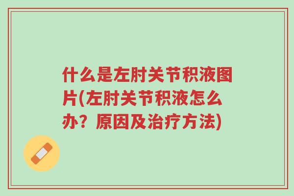 什么是左肘关节积液图片(左肘关节积液怎么办？原因及治疗方法)-第1张图片-超越