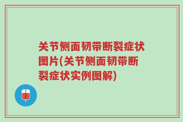 关节侧面韧带断裂症状图片(关节侧面韧带断裂症状实例图解)-第1张图片-超越 关节侧面韧带断裂症状图片(关节侧面韧带断裂症状实例图解)-第1张图片-超越