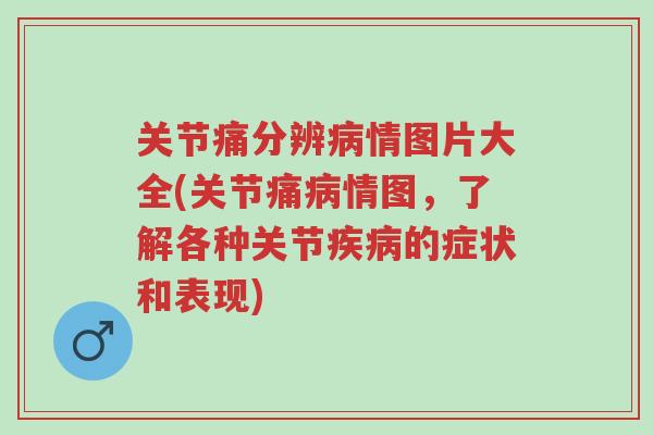 关节痛分辨病情图片大全(关节痛病情图,了解各种关节疾病的症状和表现)-第1张图片-超越 关节痛分辨病情图片大全(关节痛病情图,了解各种关节疾病的症状和表现)-第1张图片-超越