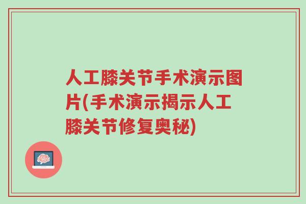 人工膝关节手术演示图片(手术演示揭示人工膝关节修复奥秘)-第1张图片-超越 人工膝关节手术演示图片(手术演示揭示人工膝关节修复奥秘)-第1张图片-超越