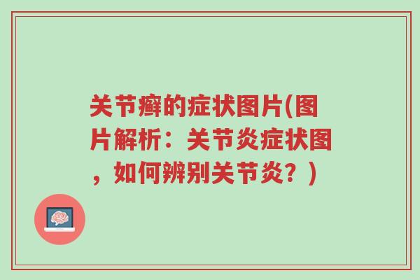 关节癣的症状图片(图片解析:关节炎症状图,如何辨别关节炎?)-第1张图片-超越 关节癣的症状图片(图片解析:关节炎症状图,如何辨别关节炎?)-第1张图片-超越