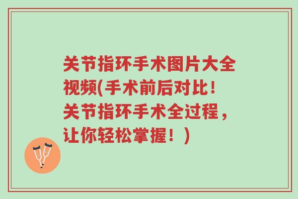 关节指环手术图片大全视频(手术前后对比!关节指环手术全过程,让你轻松掌握!)-第1张图片-超越 关节指环手术图片大全视频(手术前后对比!关节指环手术全过程,让你轻松掌握!)-第1张图片-超越