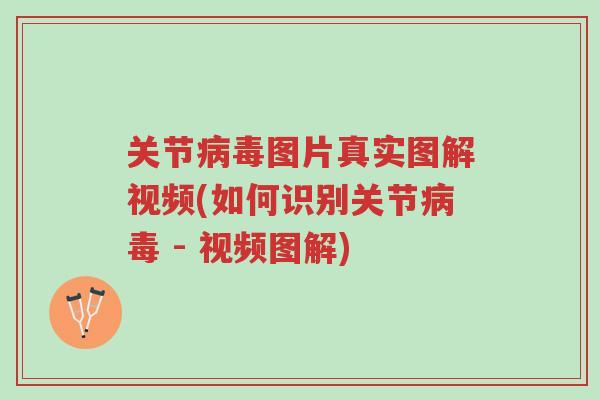 关节病毒图片真实图解视频(如何识别关节病毒 - 视频图解)-第1张图片-超越 关节病毒图片真实图解视频(如何识别关节病毒 - 视频图解)-第1张图片-超越