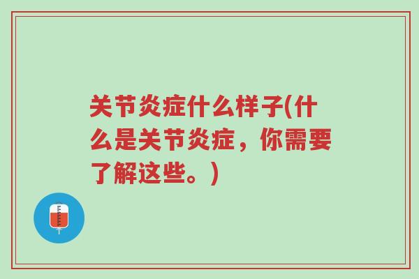关节炎症什么样子(什么是关节炎症,你需要了解这些。)-第1张图片-超越 关节炎症什么样子(什么是关节炎症,你需要了解这些。)-第1张图片-超越