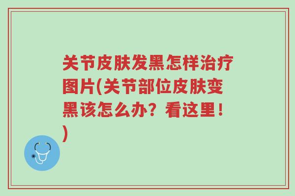 关节皮肤发黑怎样治疗图片(关节部位皮肤变黑该怎么办?看这里!)-第1张图片-超越 关节皮肤发黑怎样治疗图片(关节部位皮肤变黑该怎么办?看这里!)-第1张图片-超越