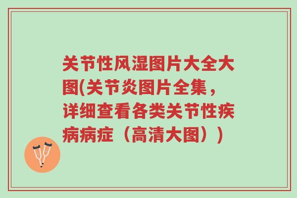 关节性风湿图片大全大图(关节炎图片全集，详细查看各类关节性疾病病症（高清大图）)-第1张图片-超越