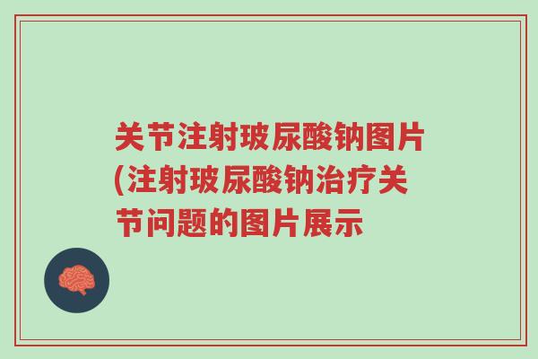 关节注射玻尿酸钠图片(注射玻尿酸钠治疗关节问题的图片展示-第1张图片-超越 关节注射玻尿酸钠图片(注射玻尿酸钠治疗关节问题的图片展示-第1张图片-超越