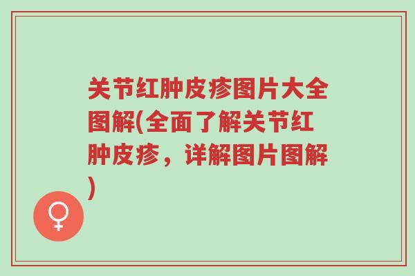 关节红肿皮疹图片大全图解(全面了解关节红肿皮疹,详解图片图解)-第1张图片-超越 关节红肿皮疹图片大全图解(全面了解关节红肿皮疹,详解图片图解)-第1张图片-超越