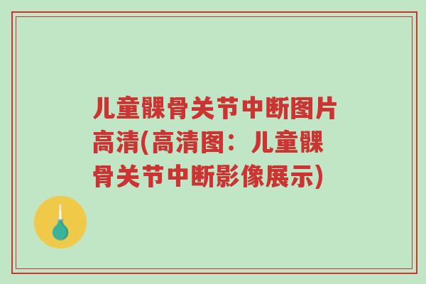 儿童髁骨关节中断图片高清(高清图:儿童髁骨关节中断影像展示)-第1张图片-超越 儿童髁骨关节中断图片高清(高清图:儿童髁骨关节中断影像展示)-第1张图片-超越