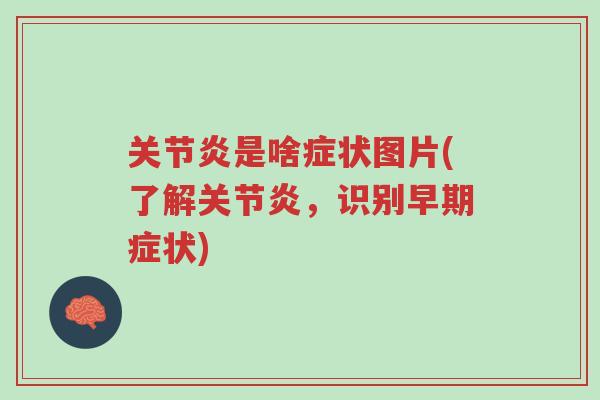 关节炎是啥症状图片(了解关节炎,识别早期症状)-第1张图片-超越 关节炎是啥症状图片(了解关节炎,识别早期症状)-第1张图片-超越