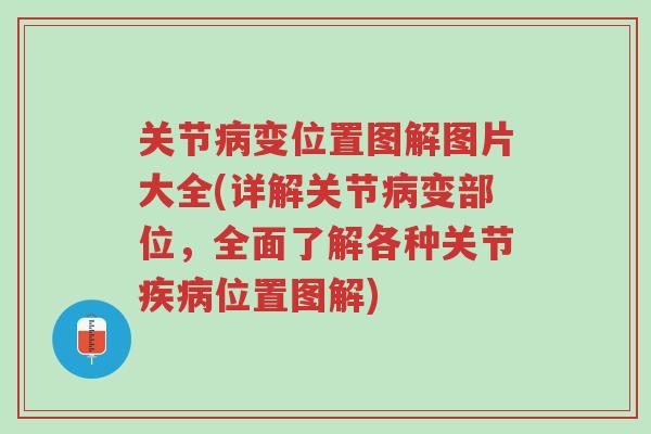 关节病变位置图解图片大全(详解关节病变部位,全面了解各种关节疾病位置图解)-第1张图片-超越 关节病变位置图解图片大全(详解关节病变部位,全面了解各种关节疾病位置图解)-第1张图片-超越