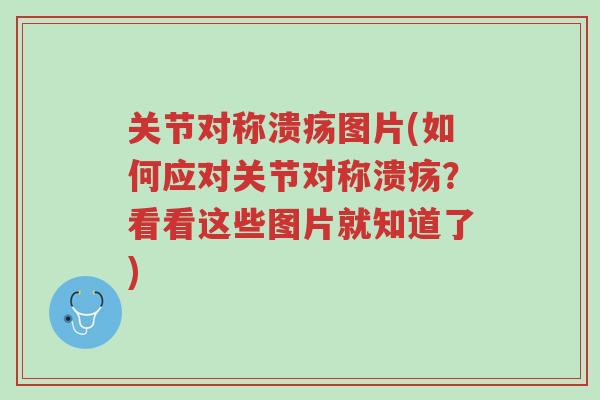 关节对称溃疡图片(如何应对关节对称溃疡?看看这些图片就知道了)-第1张图片-超越 关节对称溃疡图片(如何应对关节对称溃疡?看看这些图片就知道了)-第1张图片-超越