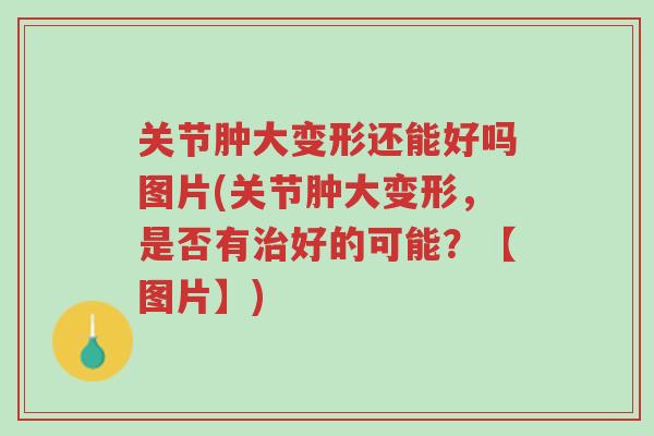 关节肿大变形还能好吗图片(关节肿大变形,是否有治好的可能?【图片】)-第1张图片-超越 关节肿大变形还能好吗图片(关节肿大变形,是否有治好的可能?【图片】)-第1张图片-超越