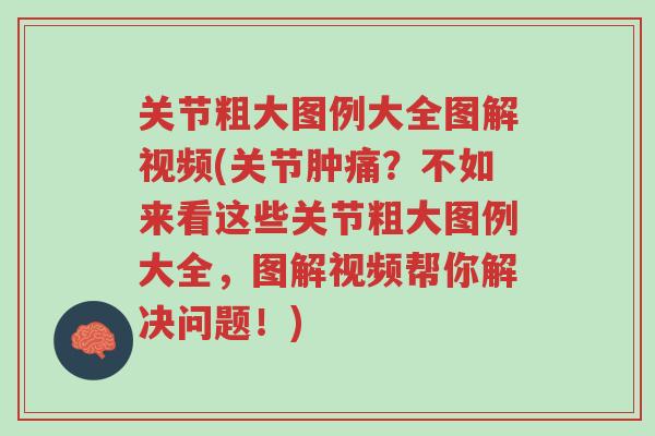 关节粗大图例大全图解视频(关节肿痛?不如来看这些关节粗大图例大全,图解视频帮你解决问题!)-第1张图片-超越 关节粗大图例大全图解视频(关节肿痛?不如来看这些关节粗大图例大全,图解视频帮你解决问题!)-第1张图片-超越