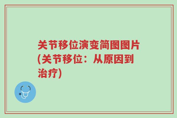 关节移位演变简图图片(关节移位:从原因到治疗)-第1张图片-超越 关节移位演变简图图片(关节移位:从原因到治疗)-第1张图片-超越
