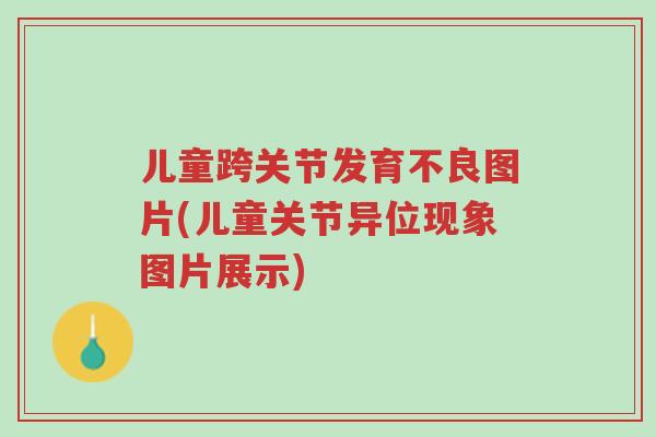 儿童跨关节发育不良图片(儿童关节异位现象图片展示)-第1张图片-超越 儿童跨关节发育不良图片(儿童关节异位现象图片展示)-第1张图片-超越