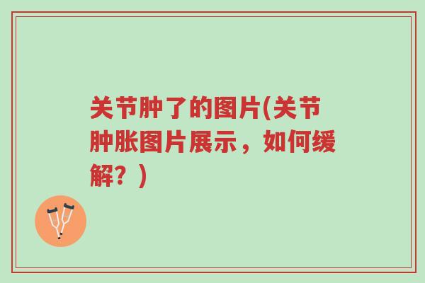 关节肿了的图片(关节肿胀图片展示,如何缓解?)-第1张图片-超越 关节肿了的图片(关节肿胀图片展示,如何缓解?)-第1张图片-超越