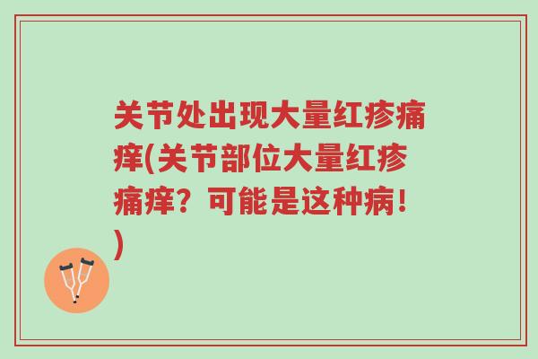关节处出现大量红疹痛痒(关节部位大量红疹痛痒?可能是这种病!)-第1张图片-超越 关节处出现大量红疹痛痒(关节部位大量红疹痛痒?可能是这种病!)-第1张图片-超越