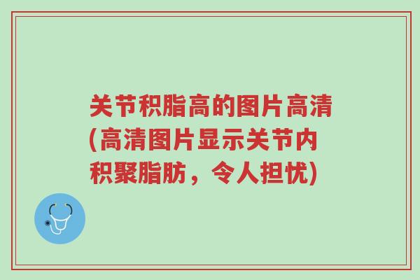 关节积脂高的图片高清(高清图片显示关节内积聚脂肪,令人担忧)-第1张图片-超越 关节积脂高的图片高清(高清图片显示关节内积聚脂肪,令人担忧)-第1张图片-超越