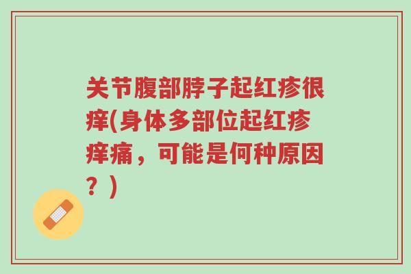关节腹部脖子起红疹很痒(身体多部位起红疹痒痛,可能是何种原因?)-第1张图片-超越 关节腹部脖子起红疹很痒(身体多部位起红疹痒痛,可能是何种原因?)-第1张图片-超越